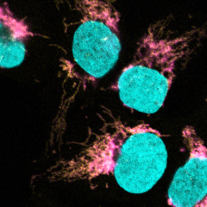 La microscòpia confocal mostra la co-localització de EXD2 (magenta) amb el ribosoma mitocondrial (groc). L'ADN es tenyeix per definir el nucli (cian).