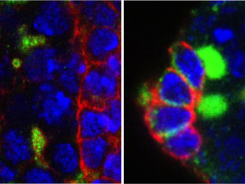 Microscòpia de les cèl·lules mare germinals (verd brillant) de l'ovari de Drosophila de les mosques que no tenen EXD2. Les mosques al panell dret van ser tractades amb antioxidants per rescatar les cèl·lules mare. Imatge: Travis Stracker, IRB Barcelona.