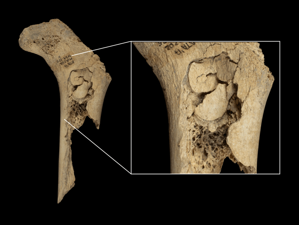 Fèmur humà infantil trobat a El Mirador, amb impactes per extreure’n el moll de l’os. Autoria: IPHES-CERCA