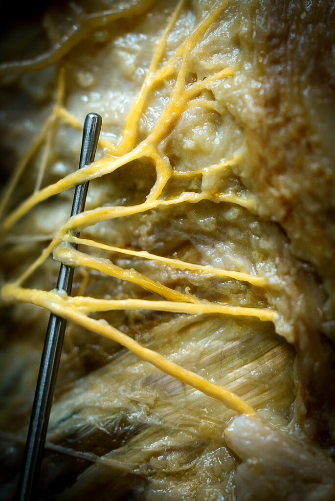 Fotografia guanyadora de la categoria #General.